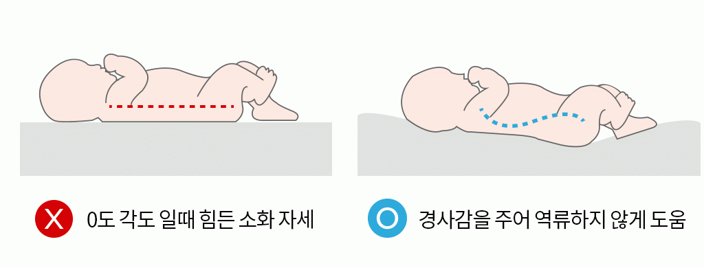 아기 변